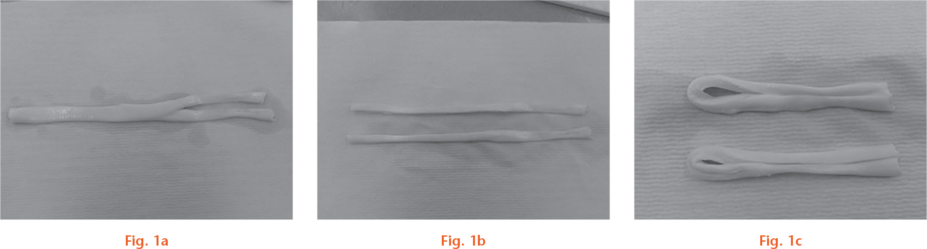 Fig. 1 
            a) Porcine superflexor tendons are harvested and decellularized. b) They are split along their long axis. c) This yields two potential double bundle anterior cruciate ligament grafts, which are trimmed down appropriately to the desired graft diameter.
          