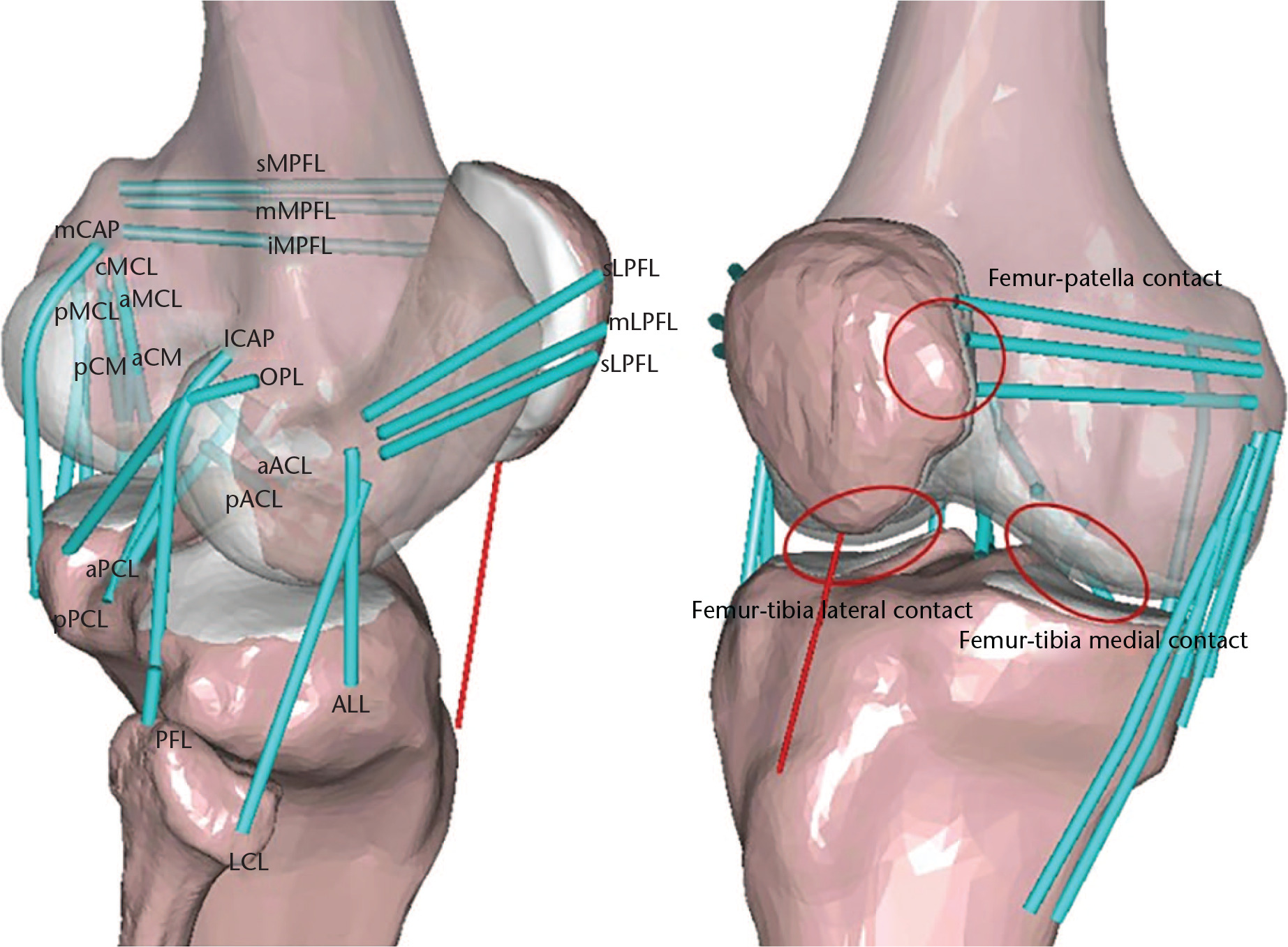 Fig. 2 
            Schematic of subject-specific musculoskeletal model during gait and squat conditions with contact conditions and 21 ligament bundles: anteromedial bundle (aACL) and posterolateral bundle (pACL) of the anterior cruciate ligament; anterolateral bundle (aPCL) and posteromedial bundle of the posterior cruciate ligament (pPCL); anterolateral ligament (ALL); lateral collateral ligament (LCL); popliteofibular ligament (PFL); anterior portion (aMCL), central portion (cMCL), and posterior portion (pMCL) of the medial collateral ligament; anterior portion (aCM) and posterior portion (pCM) of the deep medial collateral ligament; medial (mCAP) and lateral (lCAP) posterior capsules; oblique popliteal ligament (OPL); superior (sMPFL), middle (mMPFL), and inferior (iMPFL) medial patellofemoral ligament; and superior (sLPFL), middle (mLPFL), and inferior (iLPFL) lateral patellofemoral ligament.
          