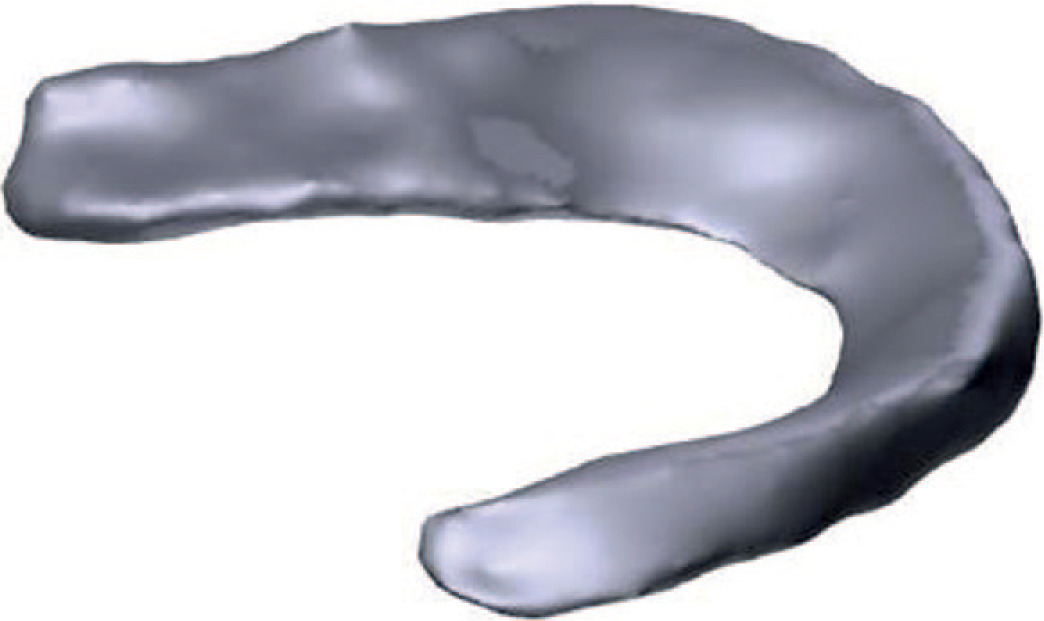 Fig. 1 
            STL model of a human meniscus.
          