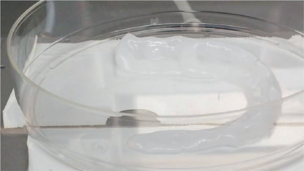 Fig. 2 
            Photograph of a custom-made, human, cell-laden, high-density collagen type I meniscus prototype after mesenchymal stem cells were embedded. The printing process was performed at room temperature in a Petri dish filled with culture medium and kept at 37°C.
          