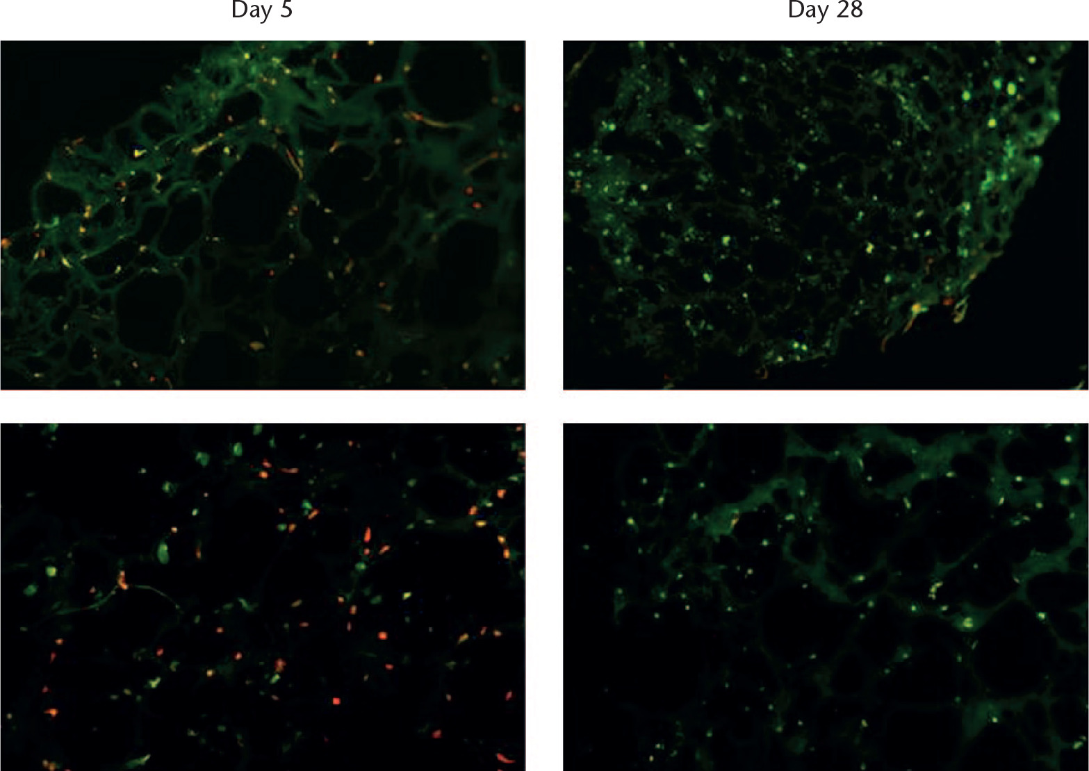 Fig. 3 
            LIVE/DEAD images of cell-laden collagen type I gel scaffolds. Viable cells are in green and dead cells in red. The top row shows slides from total meniscus structure, while the bottom row shows slides from cubical constructs. Images are representative.
          
