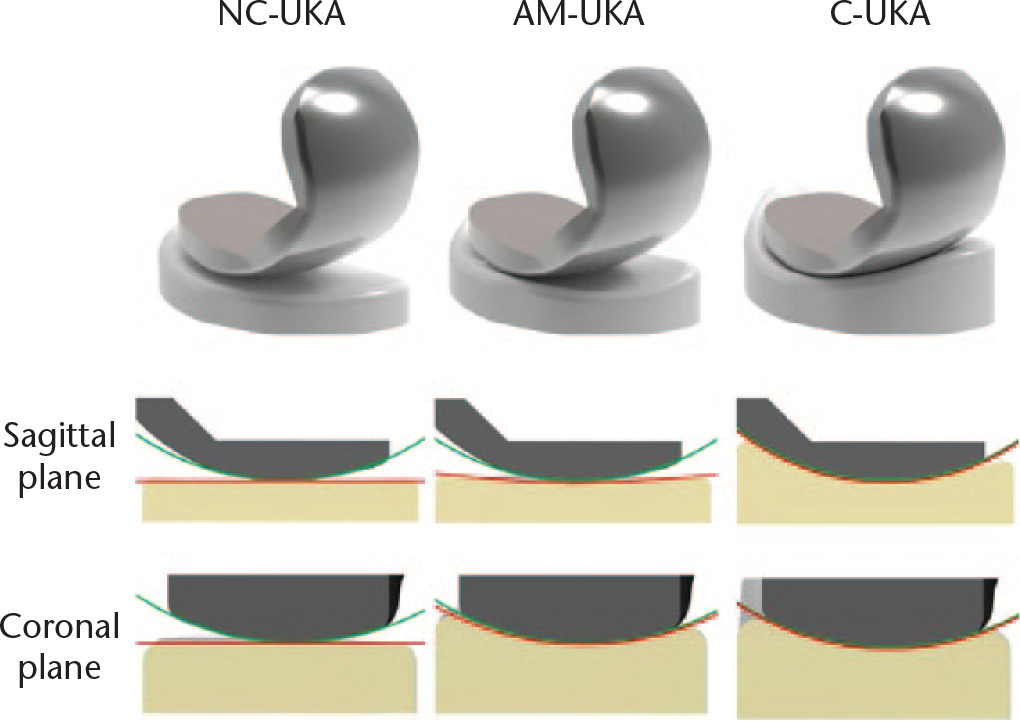 Fig. 2 
            3D model and cross section of the three different tibial inserts: nonconforming (NC) unicompartmental knee arthroplasty (UKA), anatomy mimetic (AM)-UKA, and conforming (C)-UKA.
          