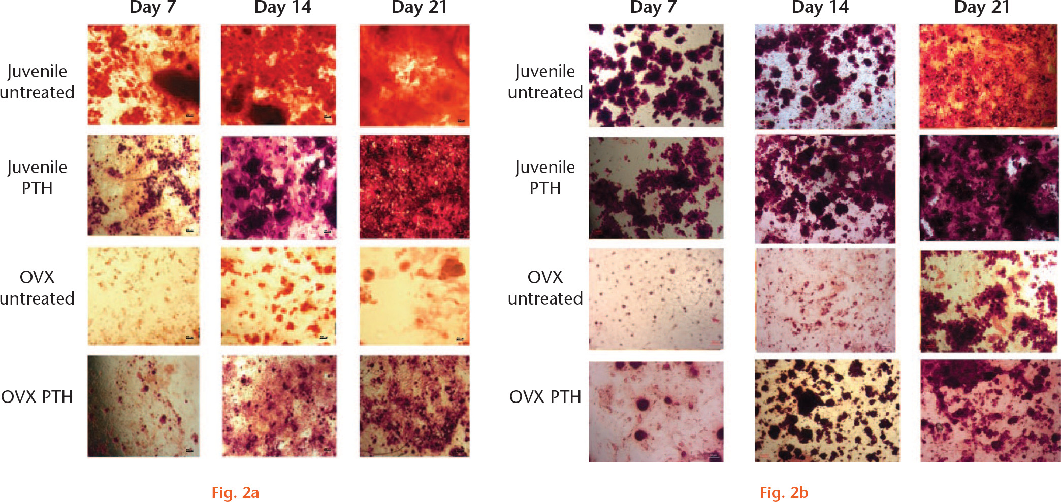 Fig. 2 
            a) Images of calcium phosphate deposition stained with alizarin red from adipose-derived cells. b) Images of calcium phosphate deposition stained with alizarin red from bone-marrow-derived cells. PTH, parathyroid hormone; OVX, ovarectomized.
          