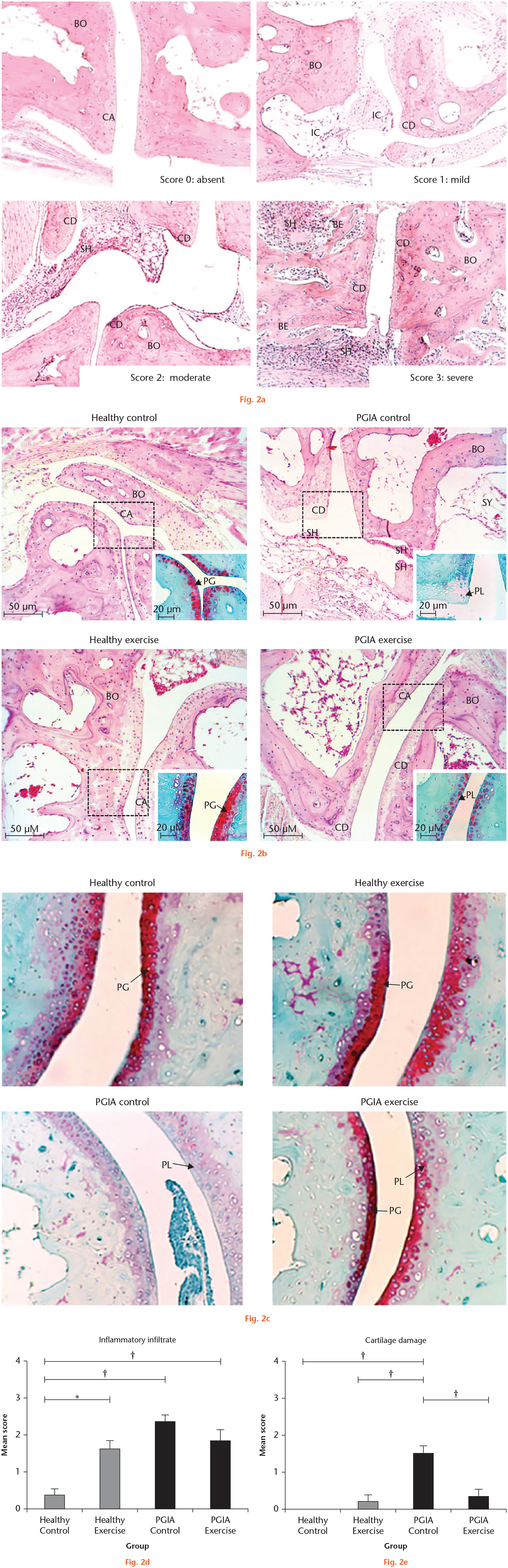 Fig. 2 
            Effects of exercise on tarsal bone histological parameters in proteoglycan-induced arthritis (PGIA) and healthy mice. a) Representative images of the inflammatory infiltrate and cartilage damage scores in the tarsal joints of PGIA mice. The 0 (normal) score was established in the control group (healthy control), where the bone, cartilage, and synovium did not show alterations. The arthritis scores 1 (mild), 2 (moderate) and 3 (severe) were based on the inflammatory changes (presence of inflammatory cells and synovial hyperplasia) and structural remodelling (cartilage damage and bone erosion). The images were acquired with a 10× amplification. b) Representative images of histological findings in the tarsal joints of the four study groups at the end of the exercise intervention using haematoxylin and eosin (H&E) and Safranin-O/Fast green staining to unveil the cartilage proteoglycan. The proteoglycan loss (PL) allowed the assessment of cartilage damage. The rectangle delimits the section of the tissue stained with Safranin-O/Fast green which is shown in the lower right corner of each image. c) Representative images of cartilage damage in the four study groups using the Safranin-O/Fast green staining to unveil the proteoglycan content and its loss. d) and e) Joint involvement was scored by the semi-quantitative scale to describe inflammatory infiltrate and cartilage damage in the tarsal joints (8 mice per group). One-way analysis of variance (ANOVA) with post hoc Tukey’s test was used to compare histological measurements between groups. *p < 0.050. †p < 0.010. BE, bone erosion; BO, bone; CA, cartilage; CD, cartilage damage; IC, inflammatory cells; PG, proteoglycan; SH, synovial hyperplasia; SY, synovium.
          