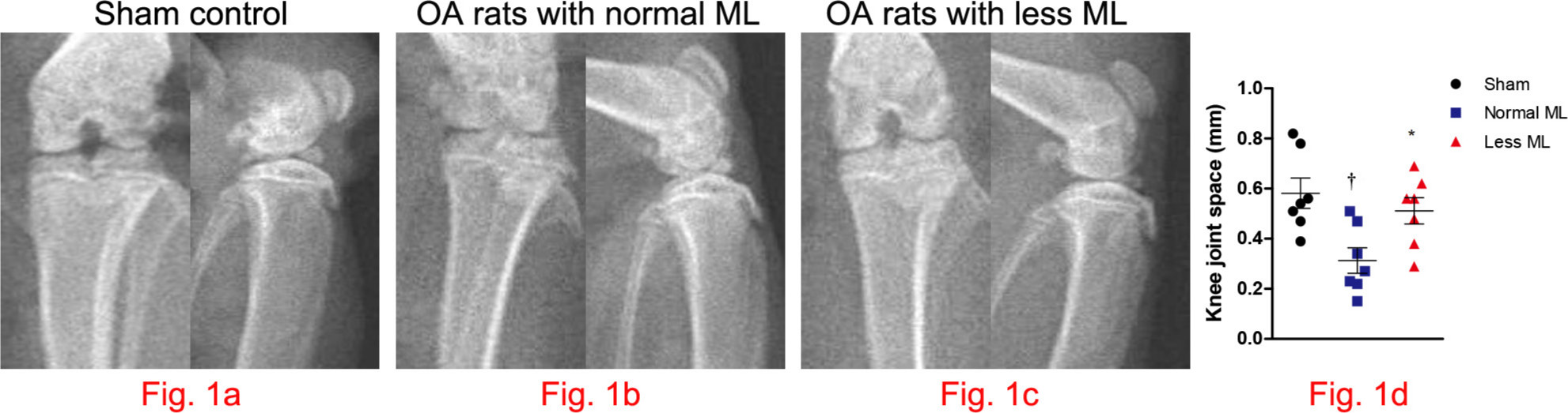 Fig. 1 
            Less mechanical loading (ML) strategy enlarging the knee joint space in an osteoarthritis (OA) rat. a) The frontal and lateral radiographs of knee joint in sham control. As compared with the narrowed and indistinct joint space in OA rats with normal ML (arrow, b), the joint space was enlarged in OA rats with less ML (arrow, c). d) Furthermore, joint space, as measured in the frontal images, enlarged significantly in rats with less ML. One-way analysis of variance (ANOVA) was used, *p < 0.05 between OA rats with normal and less ML. †p < 0.01 between sham controls and OA rats with normal ML.
          