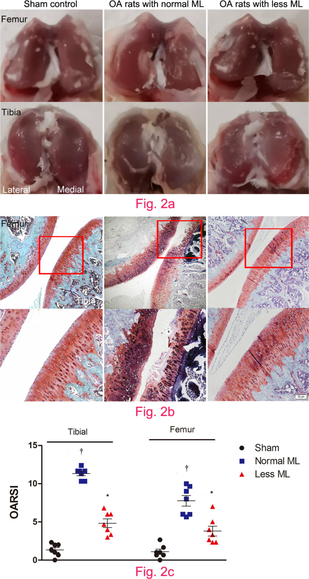 Fig. 2 
            Less mechanical loading (ML) attenuated articular cartilage degeneration in an osteoarthritis (OA) rat. a) Gross appearance of the articular cartilage in the normal ML group showed that joint surface was rough with focal defects in the proximal medial tibial plateau (lower panel), while smooth joint surface was present in the less ML joint articular cartilage. b) Safranin O and Fast Green staining demonstrated that there were some clefts and breakdown in the cartilage in OA rats with normal ML. a) and b) However, articular surface was relatively smooth and there was no evidence of breakdown in OA rats in the less ML group. c) Furthermore, the Osteoarthritis Research Society International (OARSI) scores in both tibial and femur cartilage were greater in the OA rats with normal ML than that of OA rats with less ML. Scale bar: 50 μm. Values are presented as mean and standard error of the mean (SEM). One-way analysis of variance (ANOVA) was used, *p < 0.001 between OA rats with normal and less ML. †p < 0.001 between sham controls and OA rats with normal ML. Magnification of upper panel in Fig. 2b was 100×, and lower panel was 400×.
          