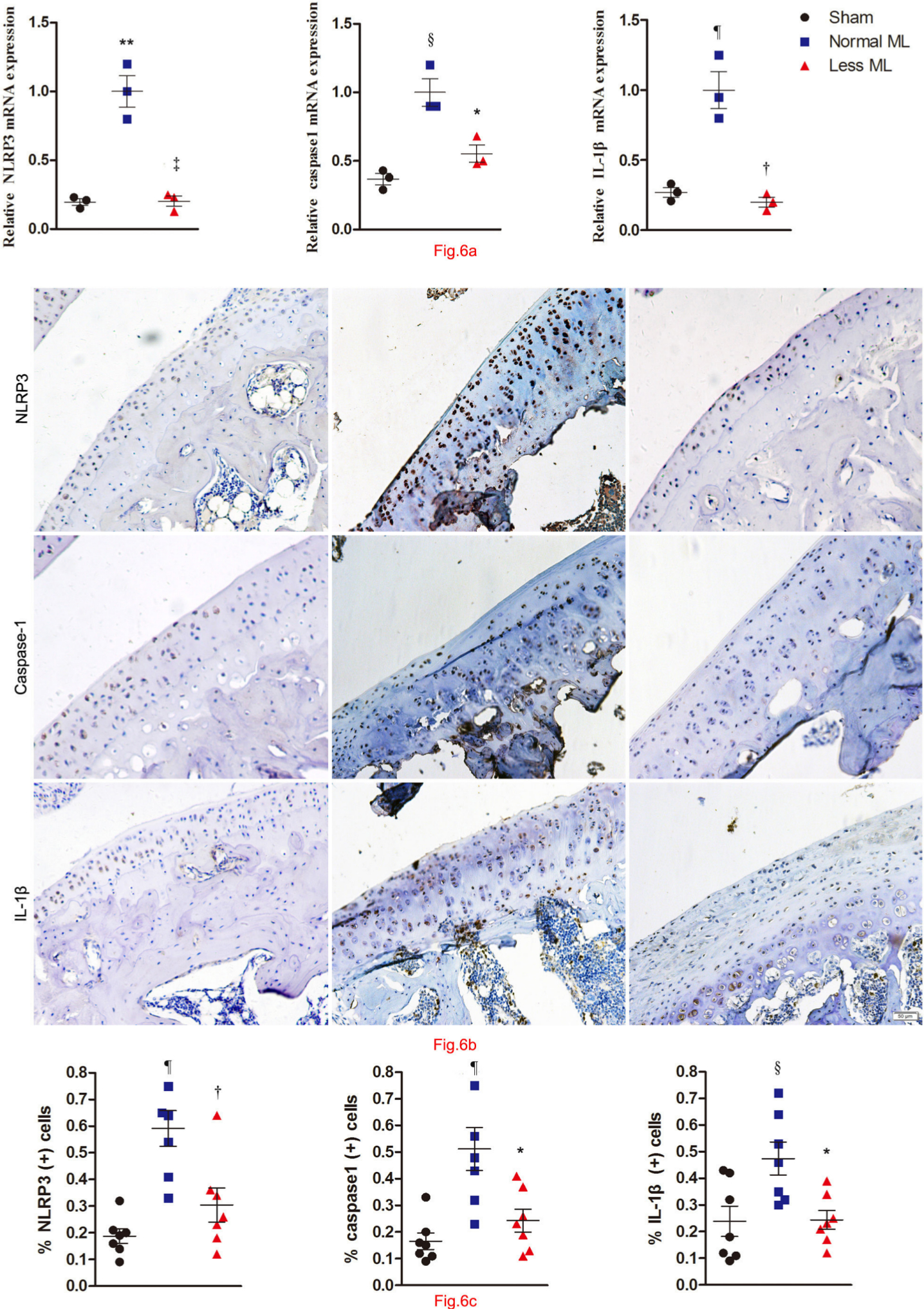Fig. 6 
            Less mechanical loading (ML) reduced the NACHT, LRR, and PYD domains-containing protein 3 (NLRP3)/caspase 1/interleukin 1β (IL-1β) expression in the cartilage of an osteoarthritis (OA) rat. a) The transcriptional level of NLRP3, caspase-1, and IL-1β was lower in the less ML group than in the normal ML group. b) Furthermore, extensive immunostaining of NLRP3, caspase-1, and IL-1β in normal ML OA cartilage was noted, whereas fewer immune-positive cells could be found in the less ML OA cartilage. The presentative images were selected from weight-bearing area of tibial cartilage. c) The percentage of immunopositive cells of NLRP3, caspase-1, and IL-1β in the less ML group was significantly lower than that of the normal ML group. Scale bar: 50 μm. Values are presented as mean standard error of the mean (SEM). One-way analysis of variance (ANOVA) was used, *p < 0.05; †p < 0.01; ‡p < 0.001, between OA rats with normal and less ML. §p < 0.05; ¶p < 0.01; **p < 0.001, between sham controls and OA rats with normal ML. Magnification in Fig. 6b: 200×.
          