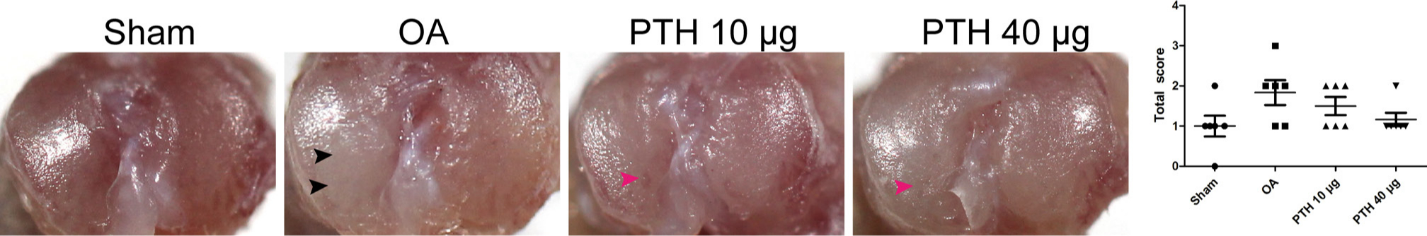 Fig. 1 
            Outline of the tibial plateau of samples and macroscopic scoring between groups. Black arrows indicate fibrillation of the tibial plateau, and pink arrows indicate surface roughening. Data are presented as the mean (SD), p-values measured using Mann-Whitney U test. OA, osteoarthritis; PTH, parathyroid hormone.
          