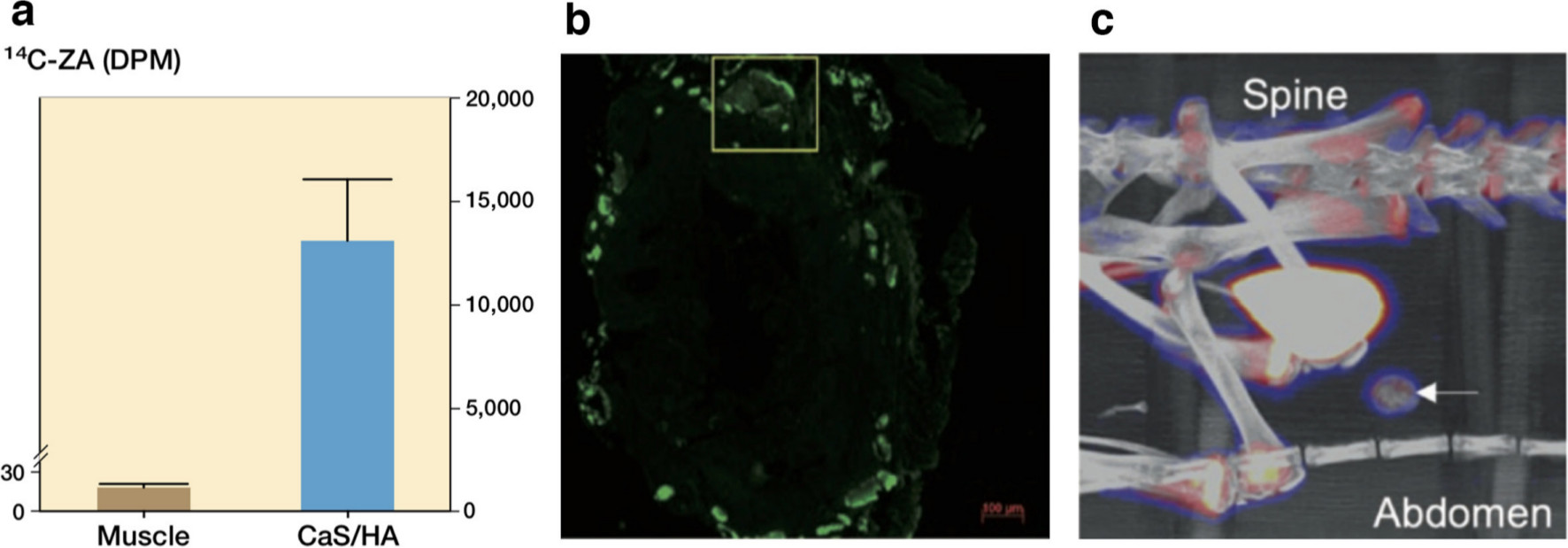 Fig. 3 
          Hydroxyapatite (HA) as a recruiting platform for systemically circulating drugs in rats. a) Uptake of 14C-zoledronic acid (ZA) in a pellet of calcium sulphate (CaS)/HA implanted in the abdominal muscle pouch. ZA was injected subcutaneously, two weeks post-implantation of CaS/HA biomaterial and animals were euthanized 24 hours later. b) and c) show the uptake of antibiotic tetracycline (injected subcutaneously) and radioactive tracer 18F (intravenous injection) in a pellet of CaS/HA biomaterial placed in the abdominal muscle pouch. Tetracycline uptake was measured using fluorescence microscopy while 18F uptake was accessed using positron emission tomography-CT. Figure has been modified from Raina et al.28
        