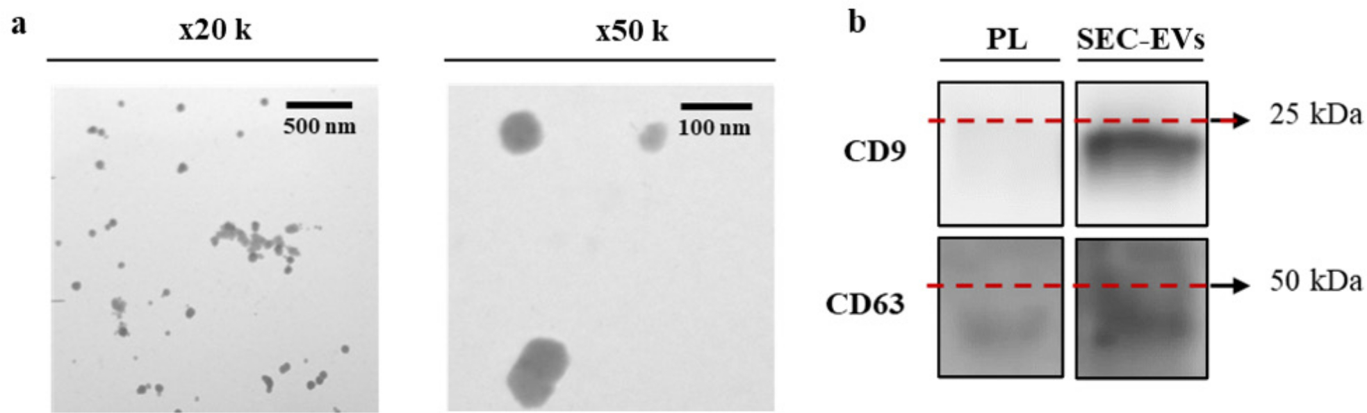 Fig. 4 
            a) Morphological characterization of size exclusion chromatography extracellular vesicles (SEC-EVs) by transmission electron microscopic imaging. Images were taken at ×20,000 augments (wide-field) and ×50,000 augments (close-up). b) Presence of EV biomarkers CD9 and CD63 for platelet lysate (PL) and the SEC-EVs determined by western blot. The same amount of protein was loaded per well (5 μg).
          