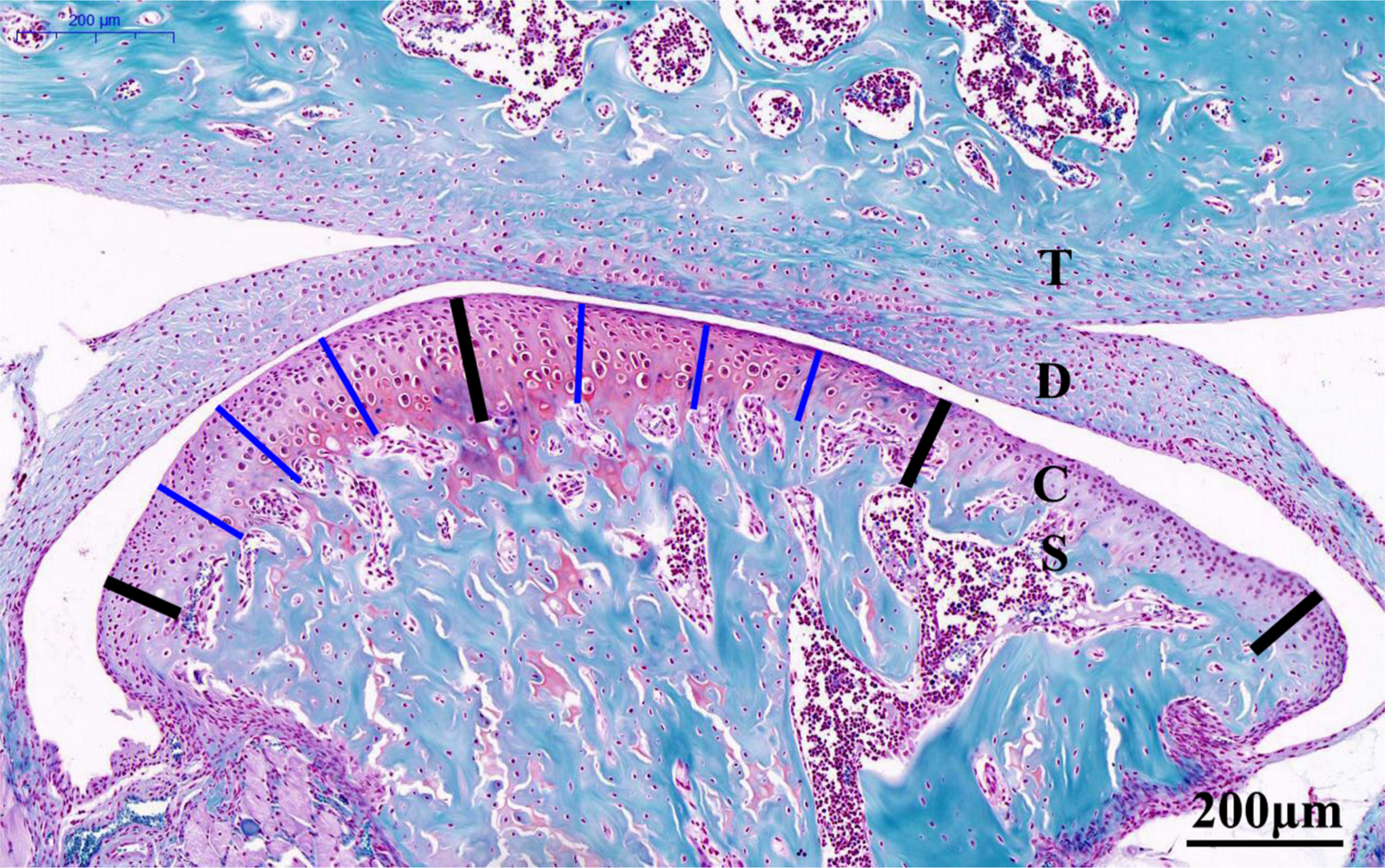 Fig. 1 
            Representative Safranin O-stained central sagittal sections (10× magnification) of the temporomandibular joint (TMJ) from six-week-old control mice (20×). The cartilage was divided into three regions, as denoted by the four bold black lines. The thickness of the central or posterior third of the cartilage was calculated as the mean length of the three thin blue lines in the corresponding thirds. The total cartilage thickness of the TMJ was calculated as the mean of the values for the central and posterior thirds. Scale bar: 200 mm. C, condylar cartilage; D, articular disc; S, subchondral bone; T: temporal bone.
          