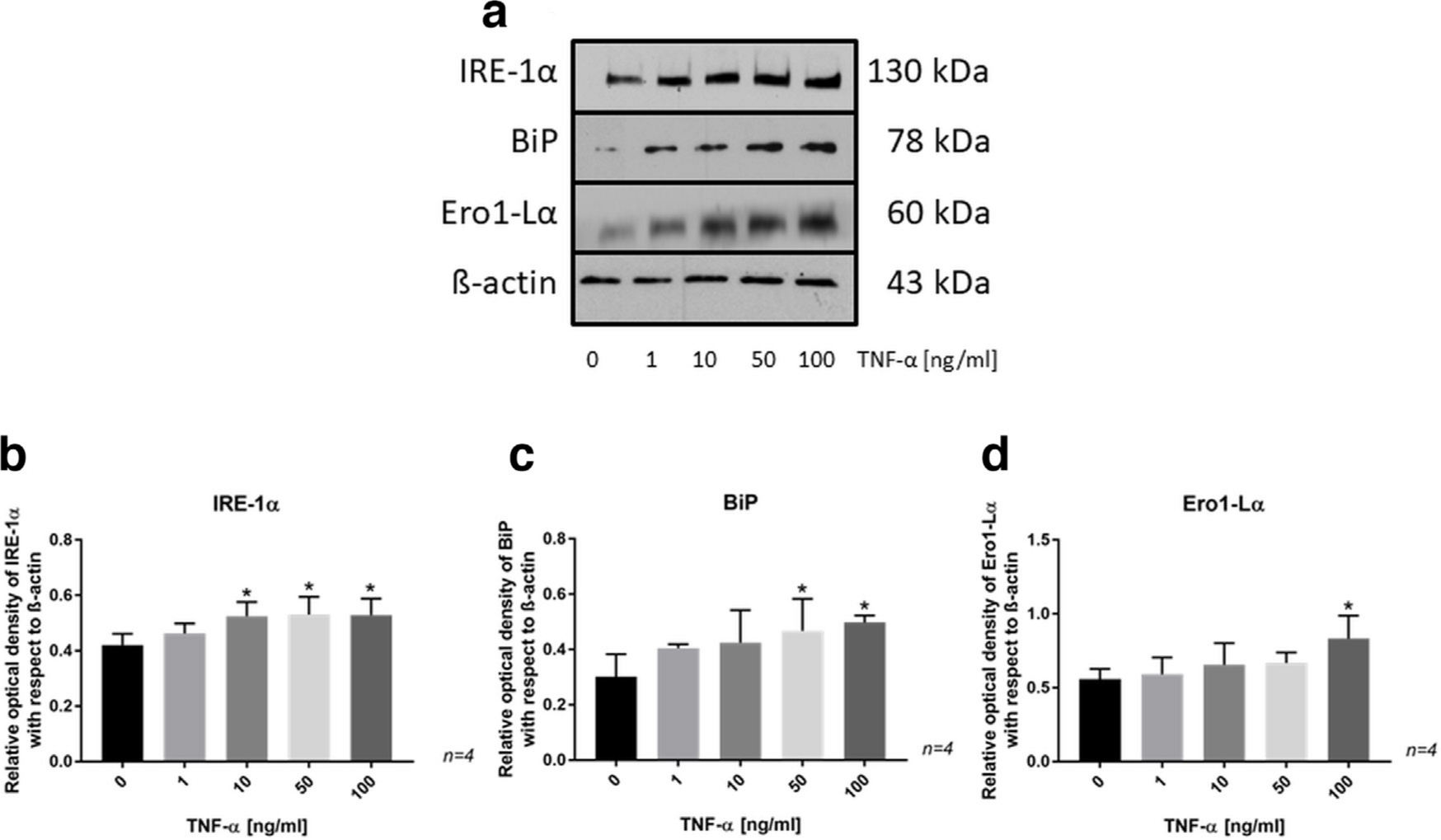 Fig. 5 
            a) Western blot showing the protein expression of inositol-requiring enzyme (IRE)-1α, binding-immunoglobulin protein (BiP), and endoplasmic reticulum (ER)-residing protein endoplasmic oxidoreductin1–Lα (Ero1-Lα) in SaOs-2 cells treated with tumour necrosis factor-alpha (TNF-α) for 24 hours. b) to d) Bar charts from protein analysis by western blotting showing significant changes in protein expression between control and TNF-α-treated SaOs-2 cells. Data are presented as the mean ± SD. *p < 0.05 versus control group, evaluated by one-way analysis of variance followed by post-hoc analysis using Dunnett’s multiple comparisons test.
          