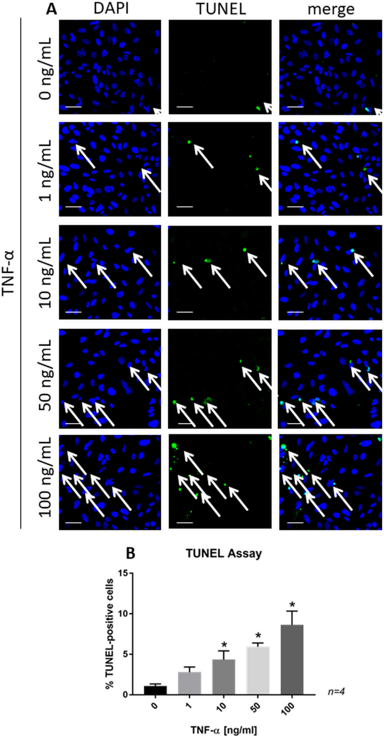 Fig. 6 
            a) Confocal images of terminal deoxynucleotidyl transferase-mediated dUTP nick end labelling (TUNEL)-stained SaOs-2 cells treated with recombinant tumour necrosis factor-alpha (TNF-α) for 24 hours. Scale bars = 50 μm. b) Bar chart representing the significant changes in the percentage of TUNEL-positive cells. Data are presented as the mean ± SD. *p < 0.01 versus control group, evaluated by one-way analysis of variance followed by post-hoc analysis using Dunnett’s multiple comparisons test. DAPI, 4′,6-diamidino-2-phenylindole.
          