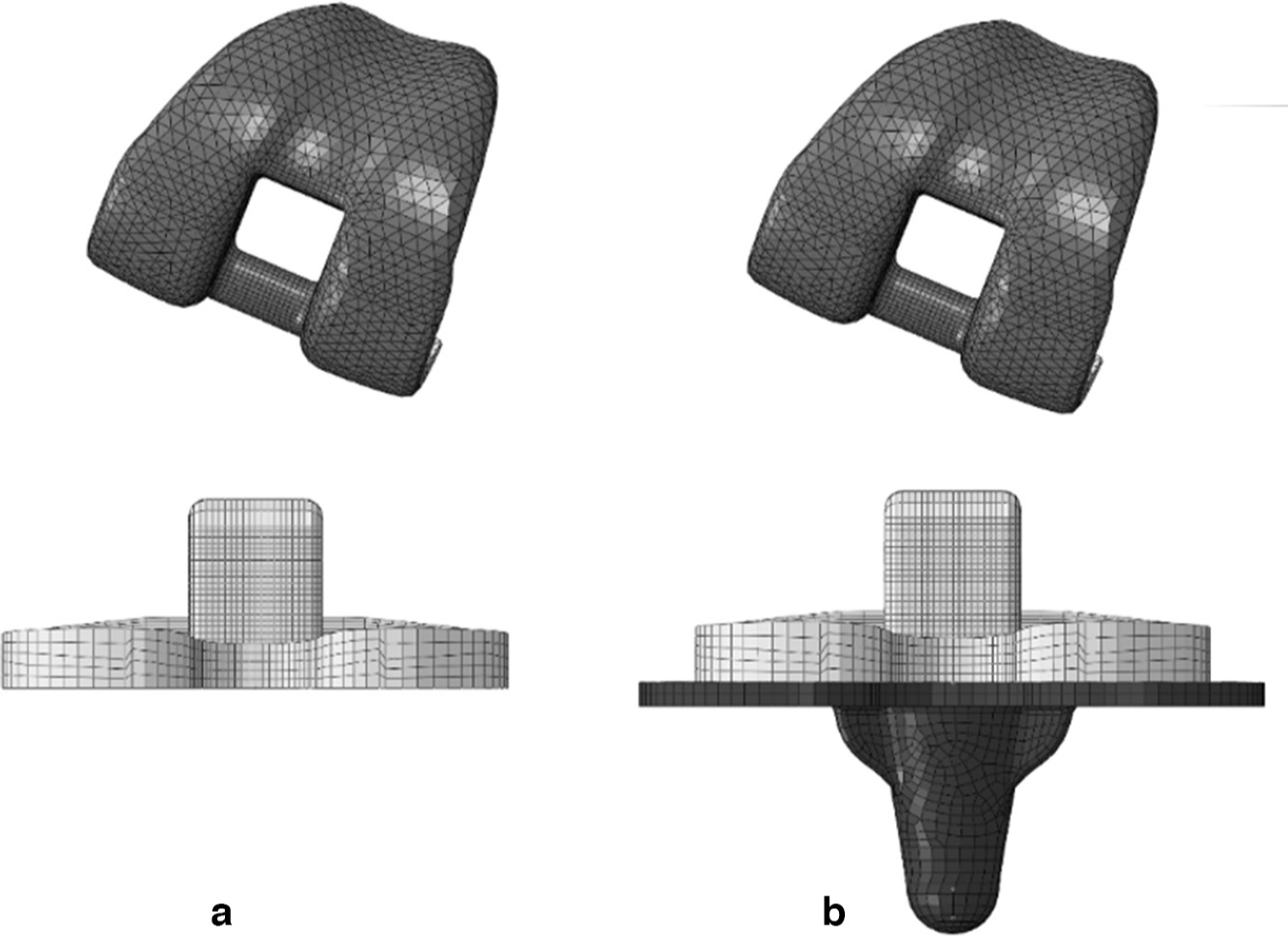 Fig. 2 
            Finite element models of a) fixed-bearing and b) mobile-bearing knee prostheses.
          
