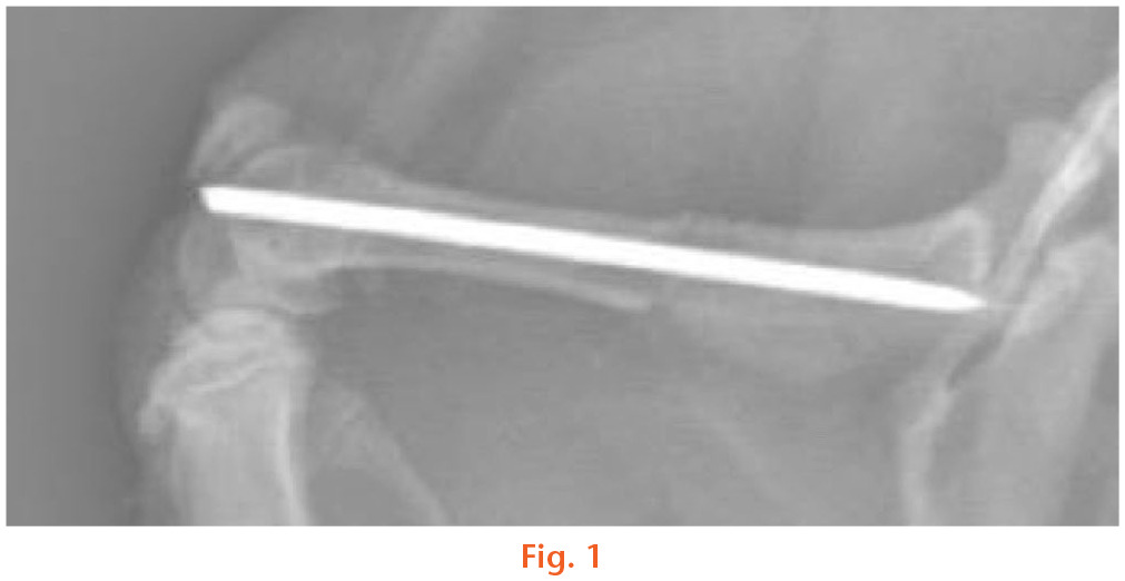 Fig. 1 
            A representative lateral radiograph after fracture creation and fixation. The femur was first stabilized with intramedullary Kirschner wire, and 1 mm protruding of the Kirschner wire was left in the knee joint for possible removal. Then, the joint and skin incision was closed with interrupted 4-0 sutures. A midshaft femoral fracture and injury to soft tissue was then created using the drop-weight impactor (800 g, 10 cm).
          
