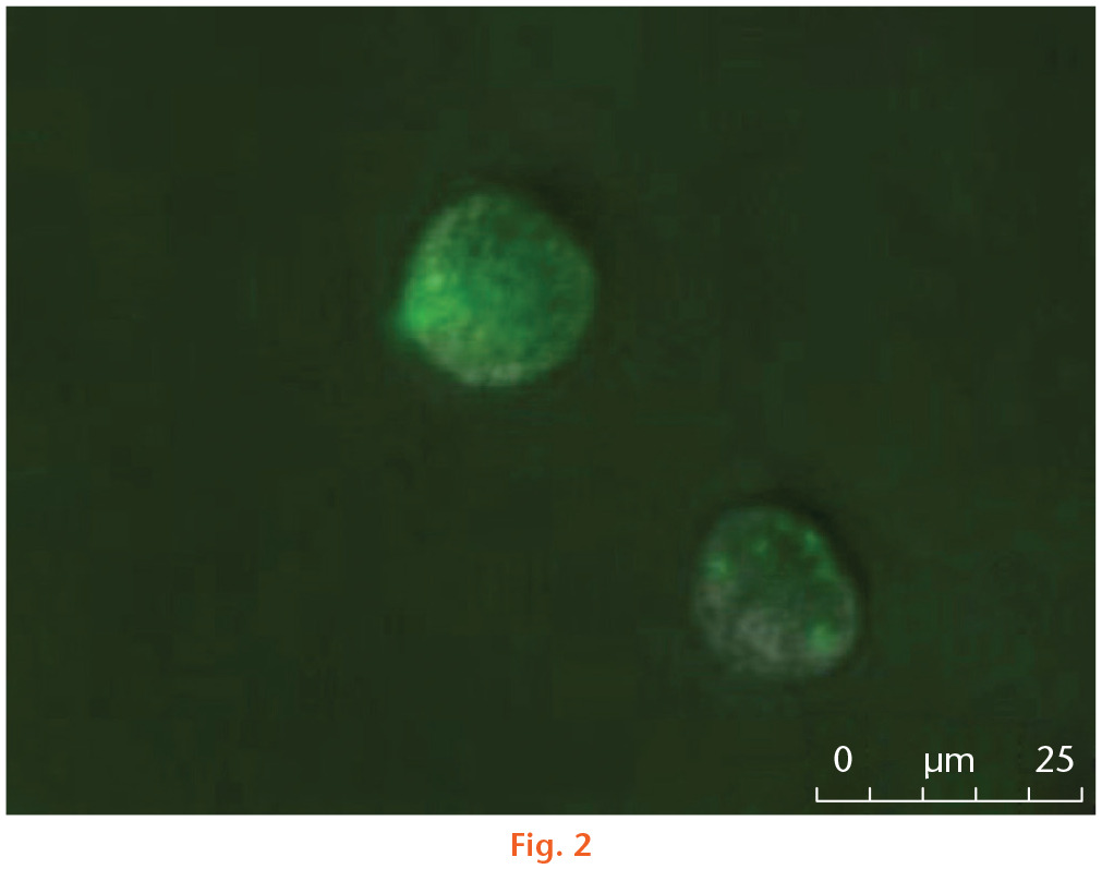 Fig. 2 
            A representative fluorescence microscopy image of the green fluorescent protein (GFP)-positive infected leucocytes. After being isolated with a flow cytometer, the GFP-positive leucocytes were detected under a fluorescence microscope. The green points indicate where GFP-tagged S. aureus were found within leucocytes.
          