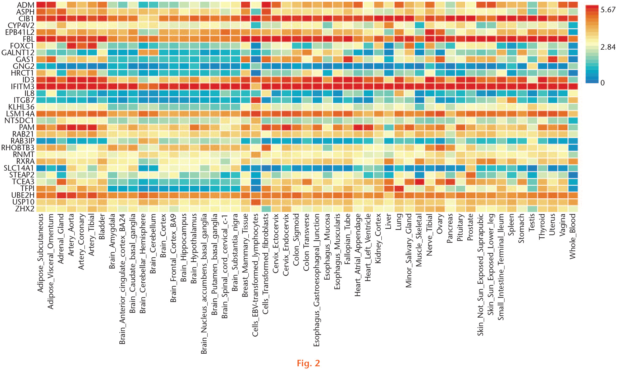 Fig. 2 
            Gene expression heat map of the identified common genes shared by transcriptome-wide association studies (TWAS) and messenger RNA (mRNA) expression data of hip osteoarthritis (OA).
          
