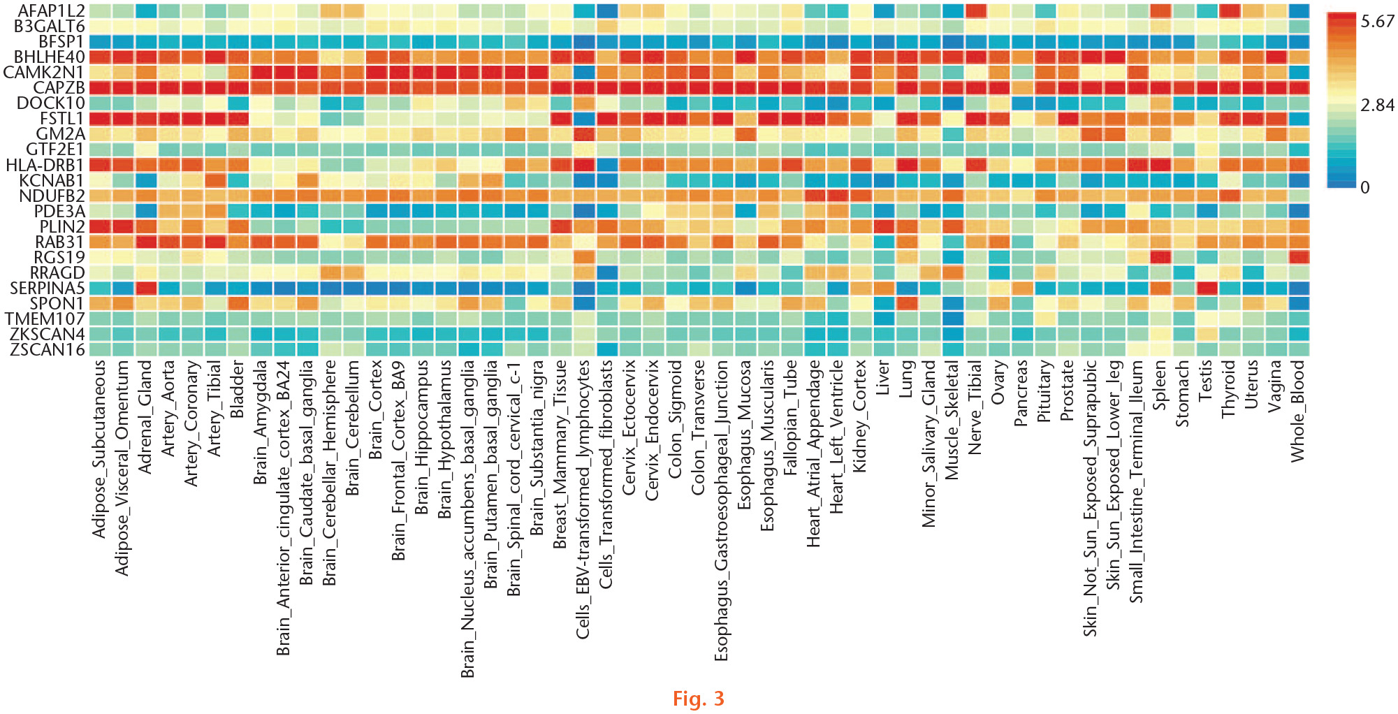 Fig. 3 
            Gene expression heat map of the identified common genes shared by transcriptome-wide association studies (TWAS) and messenger RNA (mRNA) expression data of knee osteoarthritis (OA).
          