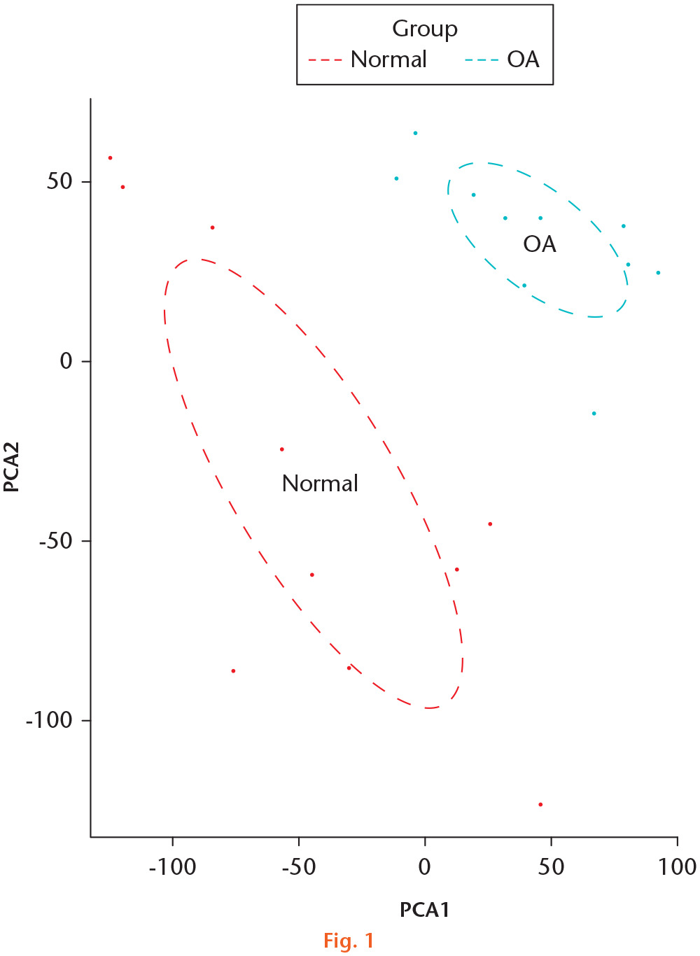Fig. 1 
            The principal component analysis (PCA) plot of gene expression in normal and osteoarthritis (OA) articular cartilage samples.
          