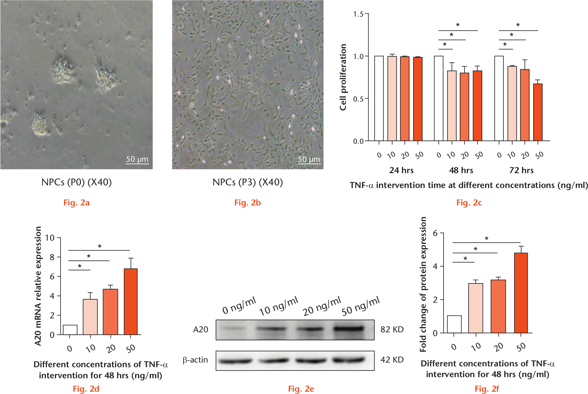 Fig. 2 
            Acquisition of rat nucleus pulposus cells (NPCs) and identification of A20 expression in tumour necrosis factor alpha (TNF-α)-induced NPCs. a) Primary NPCs. b) P3 NPCs. c) The cell viability of NPCs induced by TNF-α was evaluated. d) The messenger RNA (mRNA) expression of A20 in NPCs was evaluated by real-time polymerase chain reaction (PCR). e) The expression of A20 from TNF-α-induced NPCs was analyzed by western blot. f) Quantification of immunoblots of A20. Magnification: 127 mm × 71 mm (300 × 300 DPI). Data are expressed as means (SDs; n = 3). *p < 0.05.
          