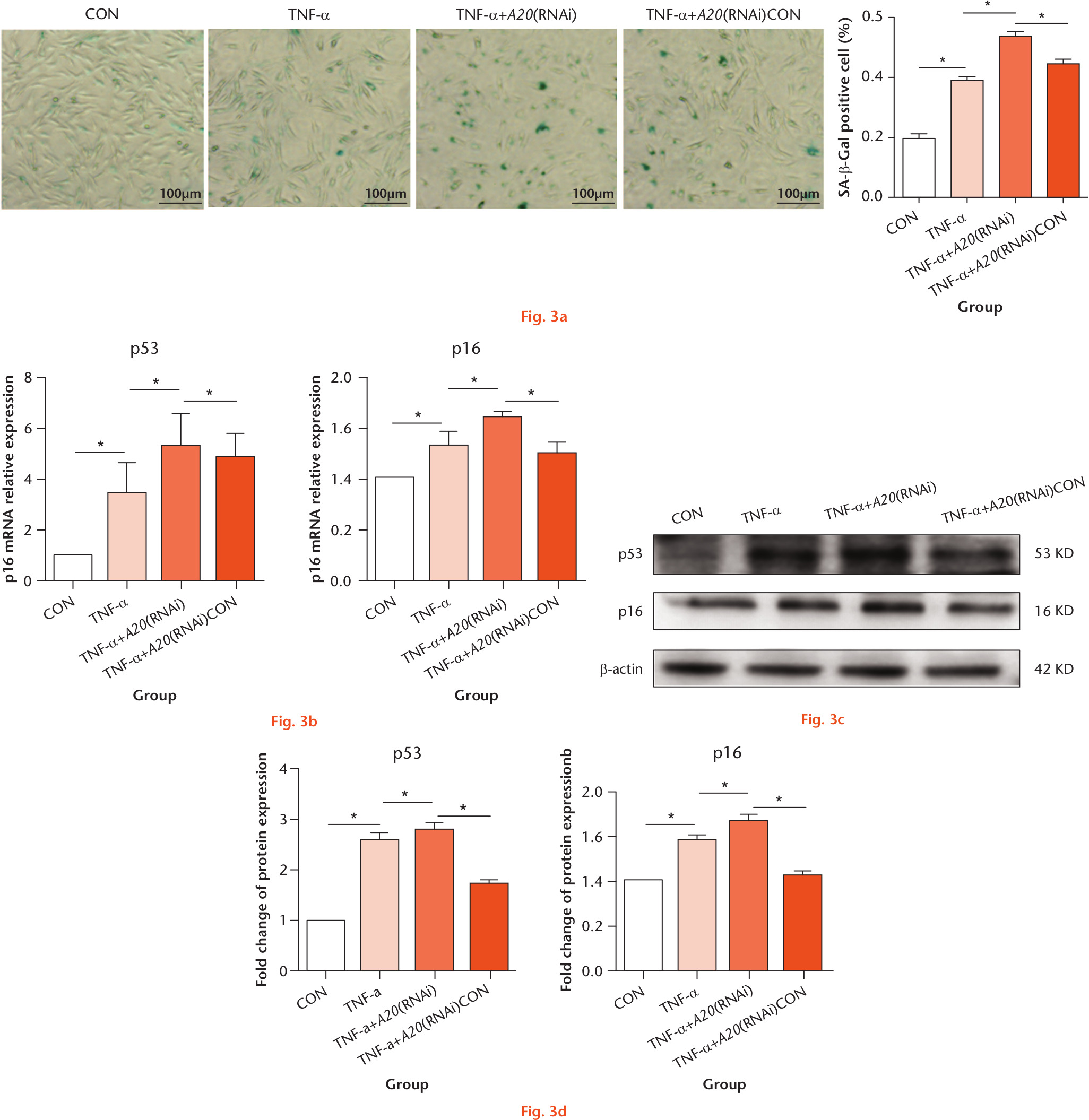 Fig. 3 
            Downregulation of A20 expression increased senescence of tumour necrosis factor alpha (TNF-α)-treated nucleus pulposus cells (NPCs). a) The positive ratio of senescence-associated beta-galactosidase (SA-β-Gal) staining is increased in TNF-α-treated NPCs with downregulated A20 expression. b) The messenger RNA (mRNA) expression of senescence-associated markers (p53, p16) in different test compounds was evaluated by real-time polymerase chain reaction (RT-PCR). c) The expression of p53 and p16 from different test compounds was analyzed by western blot. d) Quantification of p53 and p16 immunoblots. Magnification: 190 mm × 62 mm (300 × 300 DPI). Data are expressed as means (SDs; n = 3). *p < 0.05. CON, control treated with phosphate-buffered saline; RNAi, RNA interference.
          