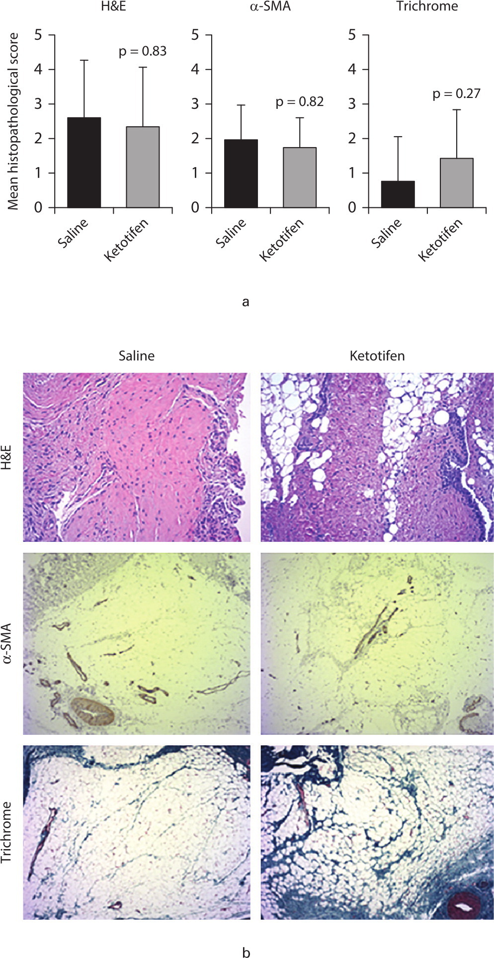 Fig. 4 
            Histopathological data showing no difference in fibrous lesions in periarticular soft tissue as assessed in haematoxylin and eosin (H&E)-stained, α-smooth muscle actin (α-SMA; myofibroblast marker)-labelled, and Masson’s trichrome-stained sections, in the rabbits that received ketotifen compared to the rabbits that received saline. This is represented by a) bar graphs depicting the mean histopathological score and b) representative images of the H&E-stained, α-SMA-labelled, and Masson’s trichrome-stained sections. Statistical significance was assessed using the Mann-Whitney U test.
          