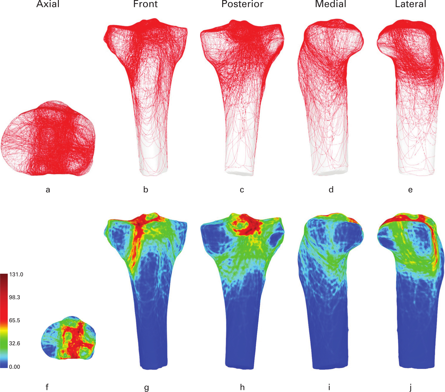 Fig. 3 
            a) to e) Representative views of the tibia template. f) to j) 3D heat mapping superimposed with all Orthopaedic Trauma Association/AO Foundation (OTA/AO) type A to C tibial plateau fracture lines (n = 766), including the axial, front, posterior, medial, and lateral views. Red colour represents a higher frequency of fracture line density.
          