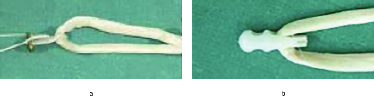 Fig. 1 
            The appearance of the decellularized porcine xenograft with two femoral fixation devices: a) Endobutton; and b) Stratis ST.
          