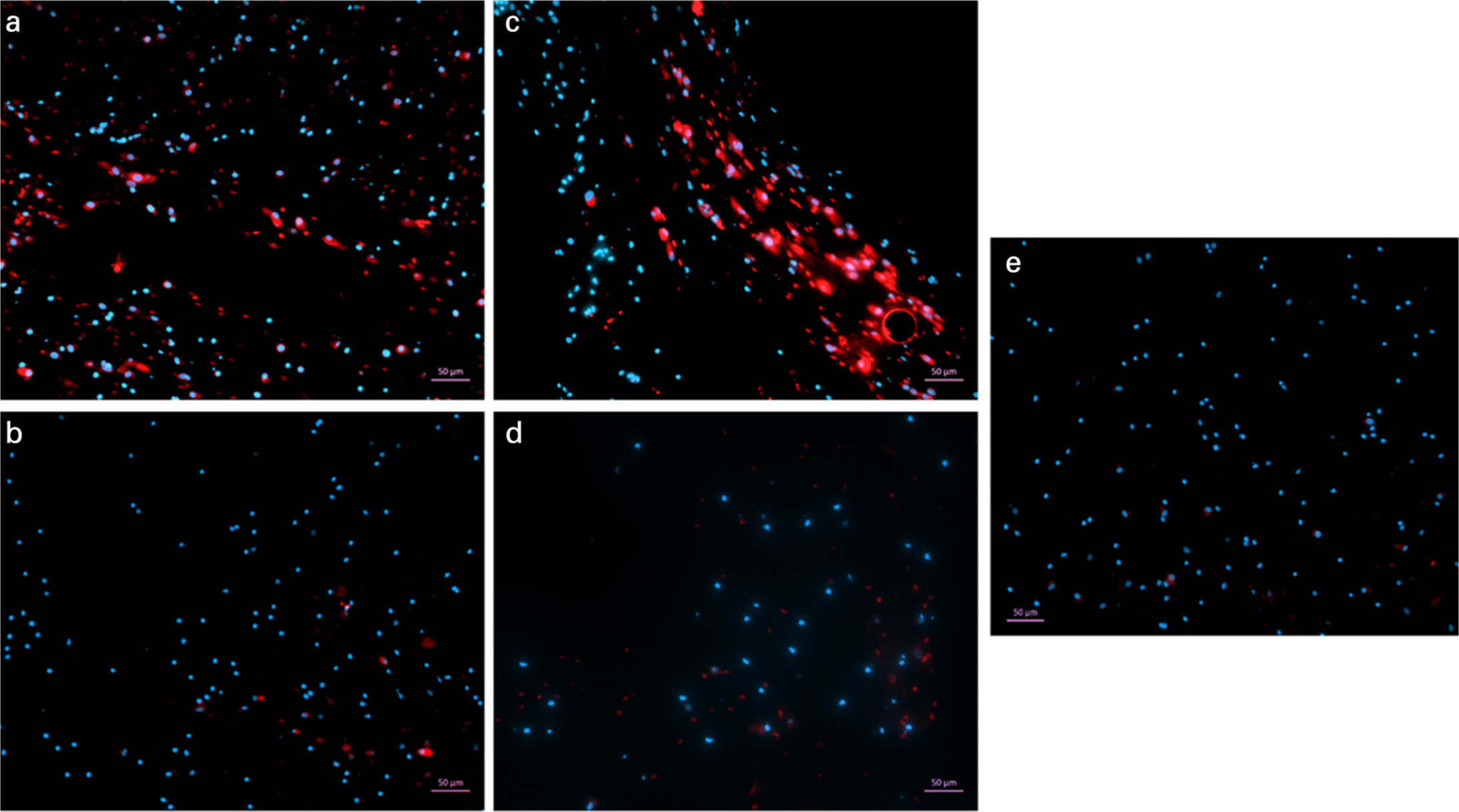 Fig. 5 
            Immunofluorescence staining of mesenchymal stem cells (MSCs) in the gel after 14 days in 2.5 times concentration gels. The gels containing bone marrow MSCs were stained for CD29-APC (A) and CD90-APC (C). Gels without any cells were also stained for CD29 (B) and CD90 (D). All gels were counter-stained with DAPI and viewed at a magnification of ×5. A control gel containing MSCs was stained with DAPI only to establish any background staining. Spindle-shaped cells visible in the gel had stained positive for CD29 and CD90.
          