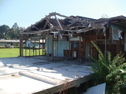 Fig. 1 
            Photograph of ward at Lae Hospital, Lae, which is under resourced and in need of repair.
          
