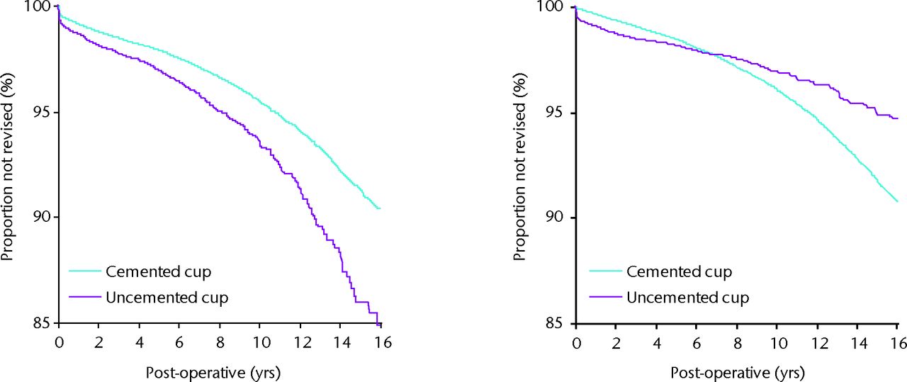 Fig. 1 
        Survival analysis of cementedversus uncemented stems and cups. Permission granted from the Swedish Hip Arthroplasty Register, 2011 (Garellick G, et al.The Swedish Hip Arthroplasty Register Annual Report, 2011.)
      