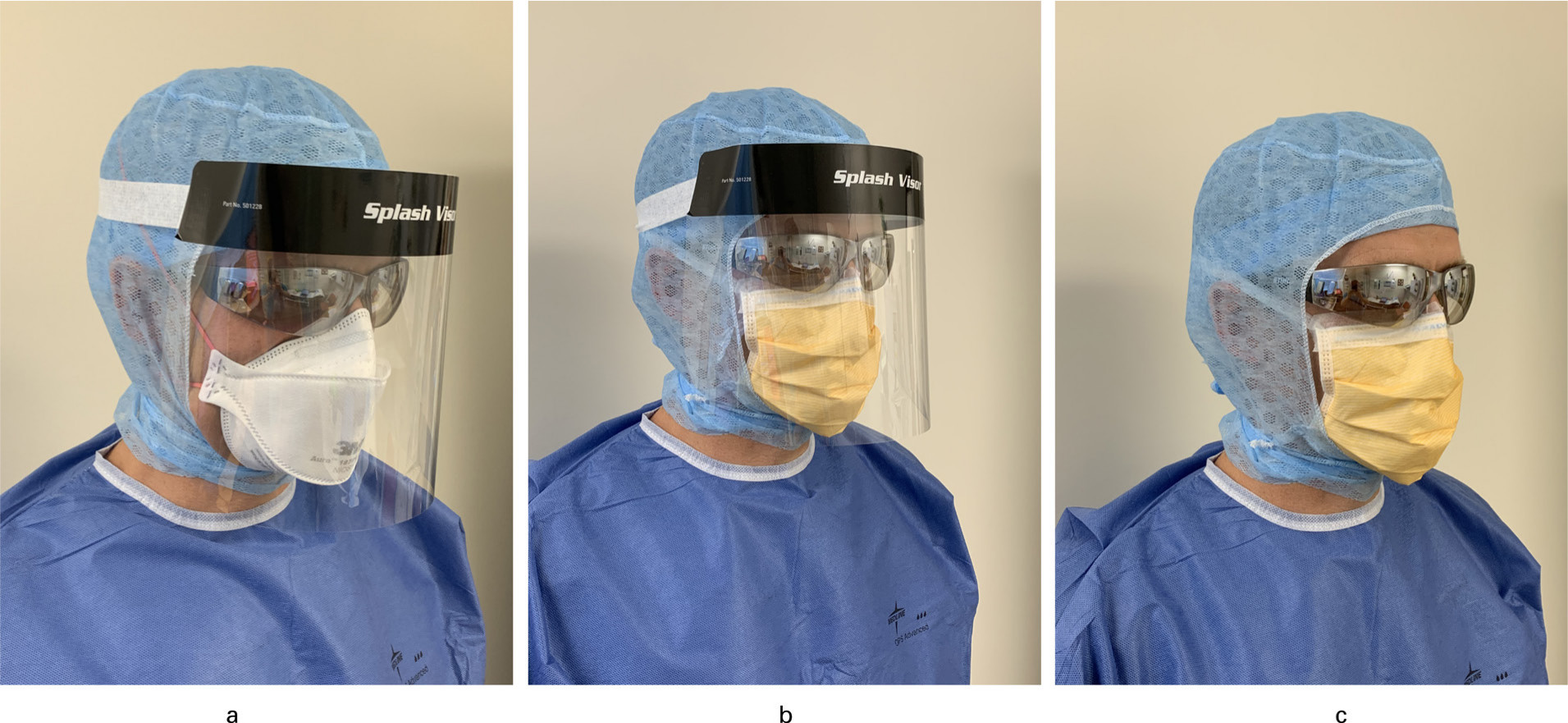 Fig. 1 
          Advised PPE use in different scenarios. a) COVID-19 positive case and suspected cases: N95 respirator, goggles, surgical balaclava, face shield, gown and double gloves. b) Non-COVID-19 case with high risk of aerosolization: taped surgical mask, goggles, surgical hood, face shield, gown and double gloves. c) Non COVID-19 case with low risk of aerosolization: taped surgical mask, goggles, surgical hood, gown and double gloves.
        
