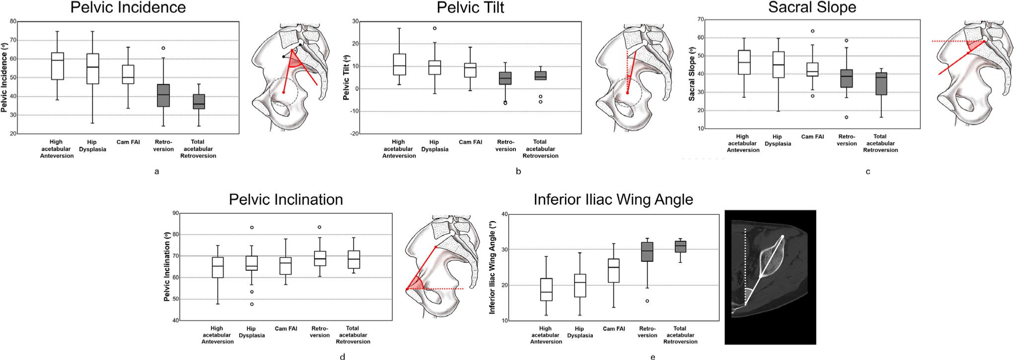 Fig. 4 
          Boxplots for a) pelvic incidence, b) pelvic tilt (PT), c) sacral slope (SS), d) pelvic inclination, and e) the inferior iliac wing angle. We found a significantly decreased PI, PT and SS for acetabular retroversion (AR) compared to hip dysplasia. In addition, we found a significantly increased inferior iliac wing angle for AR compared to hip dysplasia. The level of significance was adjusted for 6 groups (0.05/6 = 0.008). Dark boxes signify significant difference compared to hip dysplasia. FAI, femoroacetabular impingement.
        