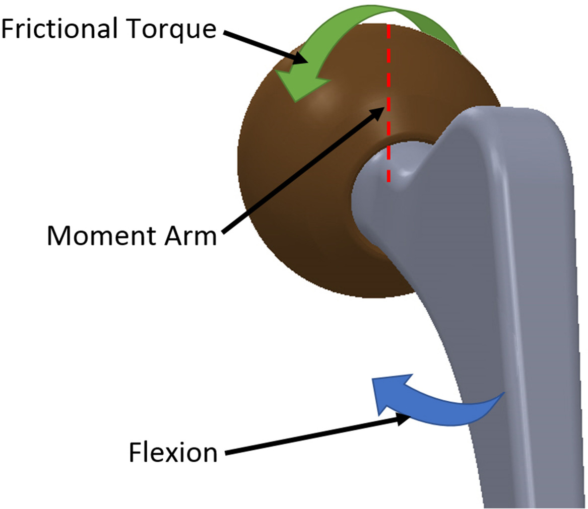 Fig. 1 
          Frictional torque induced by femoral head rotation within an acetabular cup (green) during flexion (blue) is proportionate to the moment arm (red) from the head’s outer spherical surface to the trunnion’s central axis. The moment arm increases with femoral head size as the head’s outer surface moves further from the trunnion’s central axis.
        