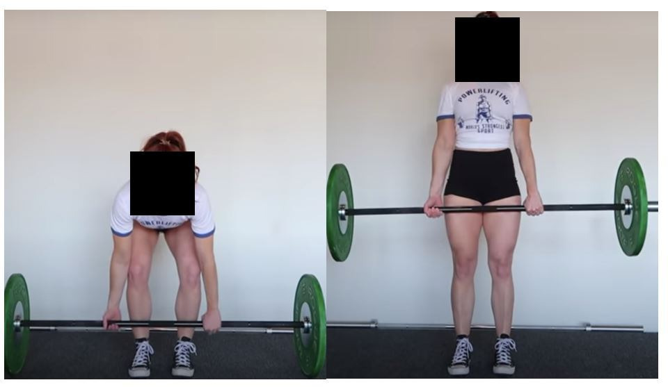 Fig. 1 
          A deadlift performed with a mixed supinated (right arm) and pronated (left arm) grip.
        