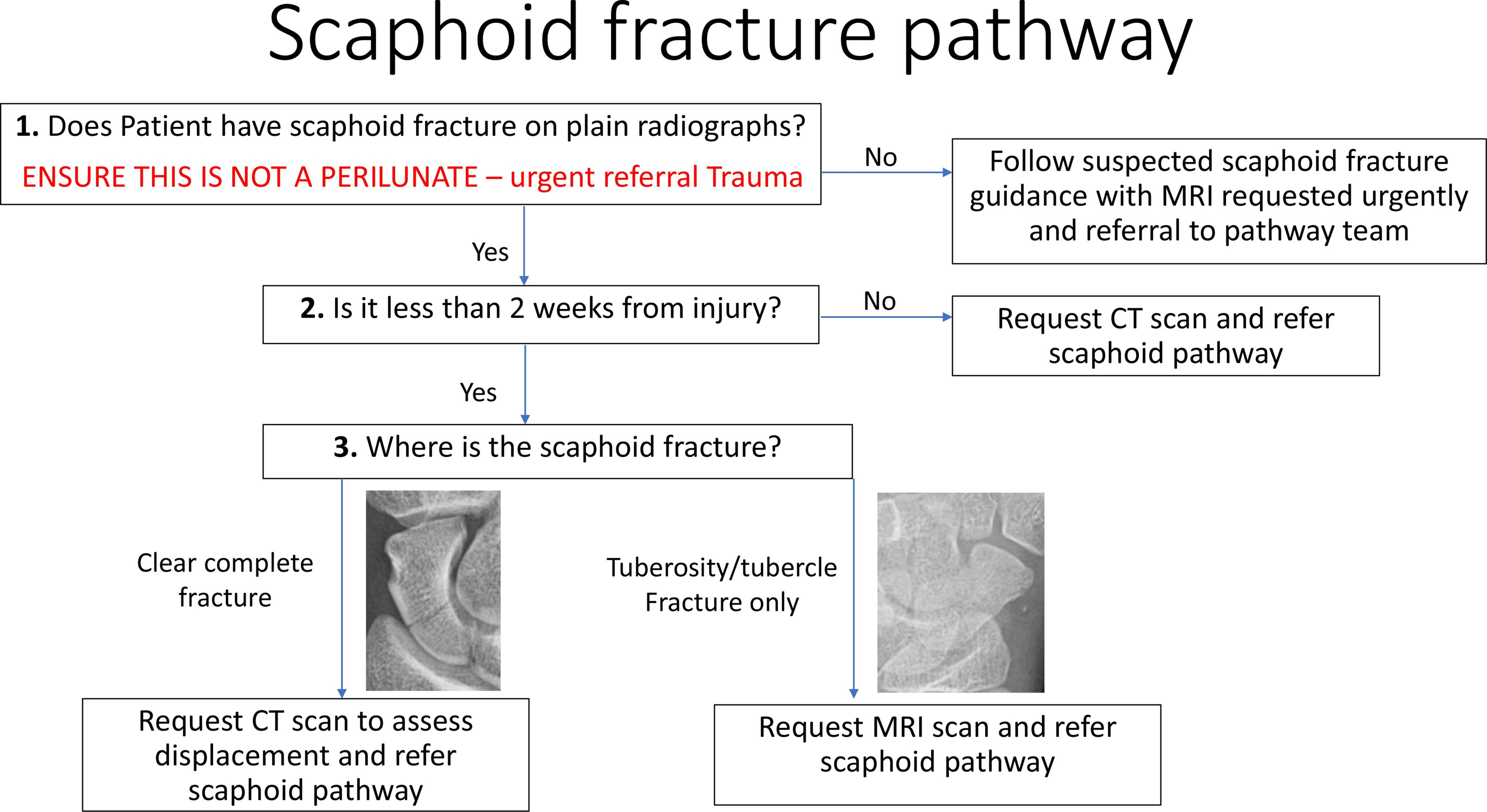 Fig. 3 
          Our latest clinical algorithm for the management of acute scaphoid injuries.
        