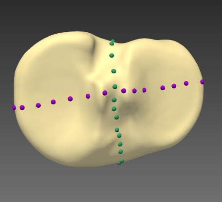 Fig. 2 
            Tibial bone model regions based on anatomical landmarks.
          