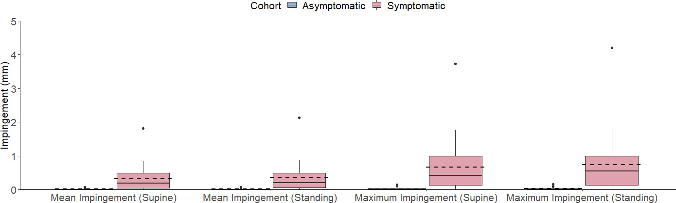 Fig. 5 
          Mean and maximum impingement results for the symptomatic and asymptomatic cohorts in supine and standing positions. The symptomatic cohort had significantly greater mean and maximum impingement values in both standing and supine.
        