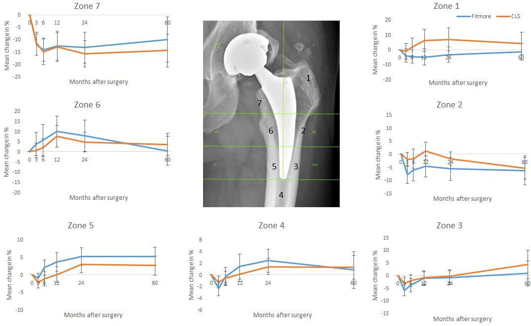 Fig. 3 
            Change in bone mineral density loss in % related to Gruen zones. Mean ± 2 standard errors of the mean.
          