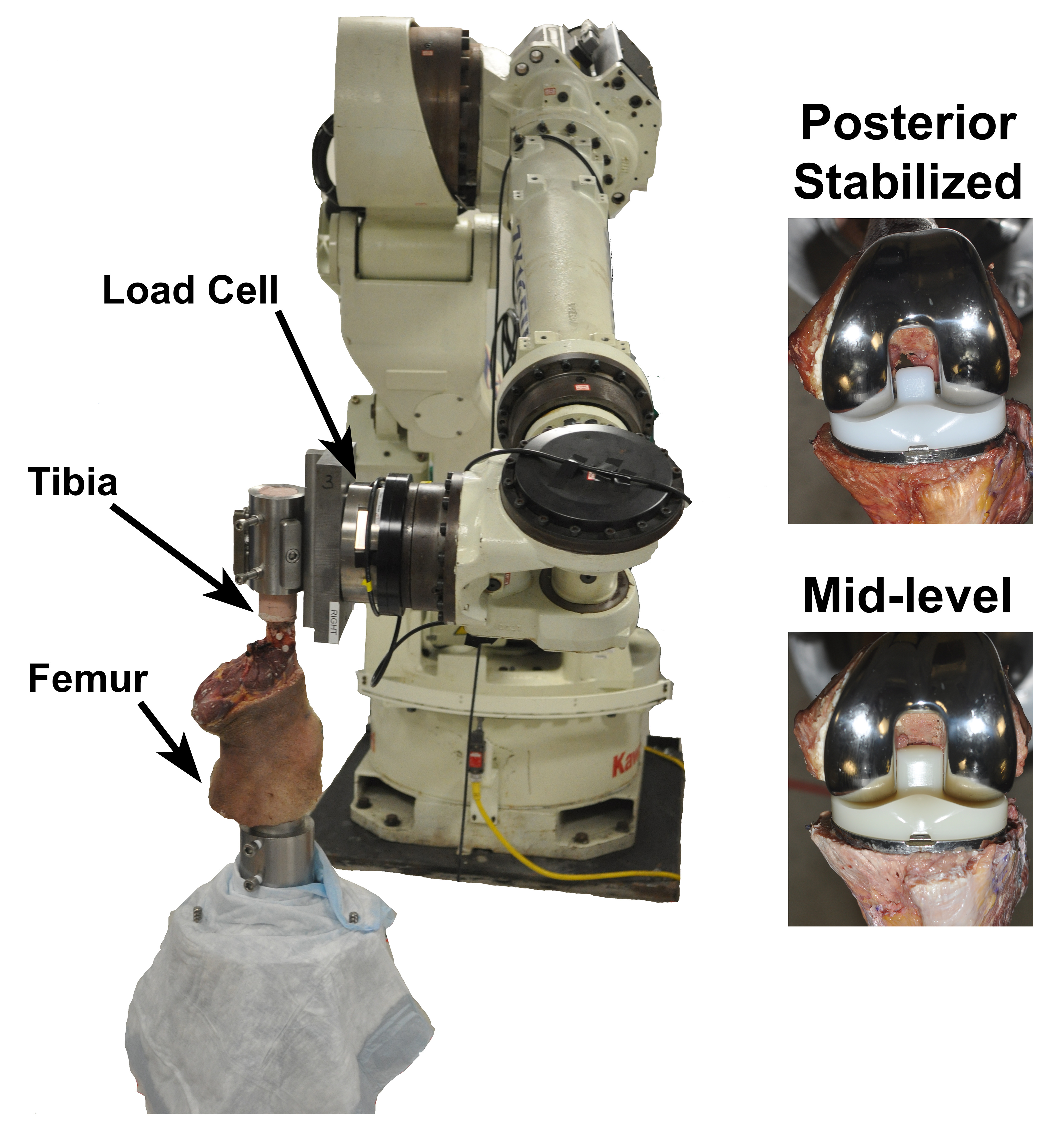 Fig. 2 
            Robotic manipulator with six-axis force/torque sensor (load cell) with cadaveric knee specimen mounted in place. Each specimen was tested with the posterior-stabilized and mid-level tibial inserts (Persona; Zimmer Biomet, USA) shown to the right.
          